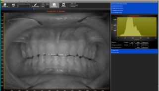 LightningChart.NET案例研究(六):東芬蘭大學多光譜圖像的數據可視化 LightningChart.NET案例研究(六):東芬蘭大學多光譜圖像的數據可視化
